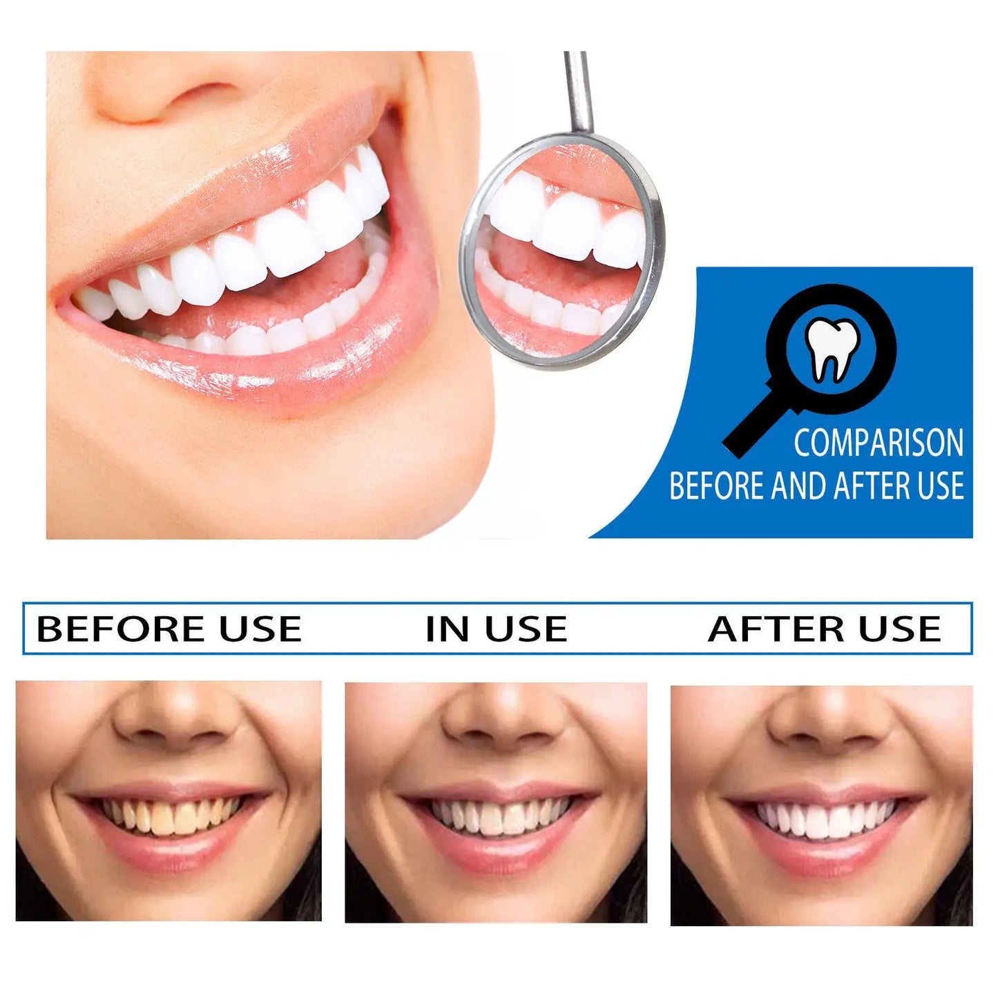 EFERO Teeth Whitening Essence Removes Plaque Stains Tooth Bleaching Cleaning Serum White Teeth Oral Hygiene Tooth Whitening