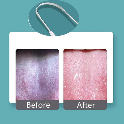 혀 스크레퍼 Hot 1PC Stainless Steel Tongue Scraper Cleaner Fresh Breath Cleaning Coated Tongue Toothbrush Oral Hygiene Care Tools