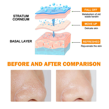 Enzymes Exfoliating Brightening Gel Salicylic Acid Blackhead Dead Skin Remover Cleansing Shrink Pores Brightening Delicate Skin