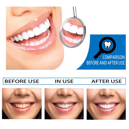 EFERO Teeth Whitening Essence Removes Plaque Stains Tooth Bleaching Cleaning Serum White Teeth Oral Hygiene Tooth Whitening