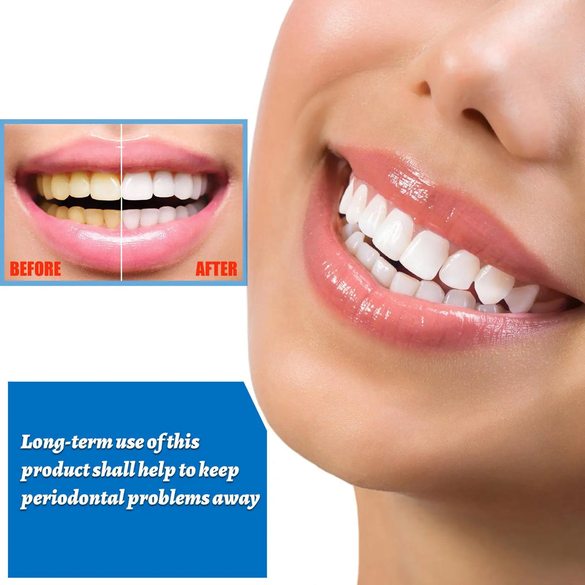 EFERO Teeth Whitening Essence Removes Plaque Stains Tooth Bleaching Cleaning Serum White Teeth Oral Hygiene Tooth Whitening