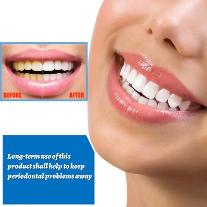 EFERO Teeth Whitening Essence Removes Plaque Stains Tooth Bleaching Cleaning Serum White Teeth Oral Hygiene Tooth Whitening