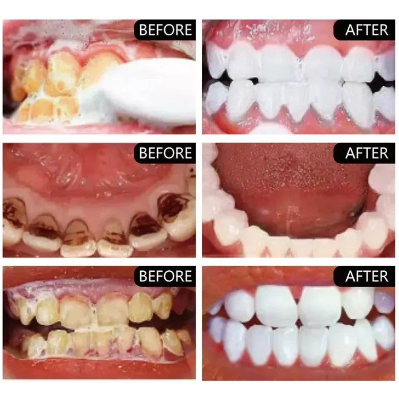 5 Days Teeth Whitening Powder Toothpaste Remove Plaque Stains Dental Calculus Oral Hygiene Cleaning Fresh Bad Breath Tooth Care